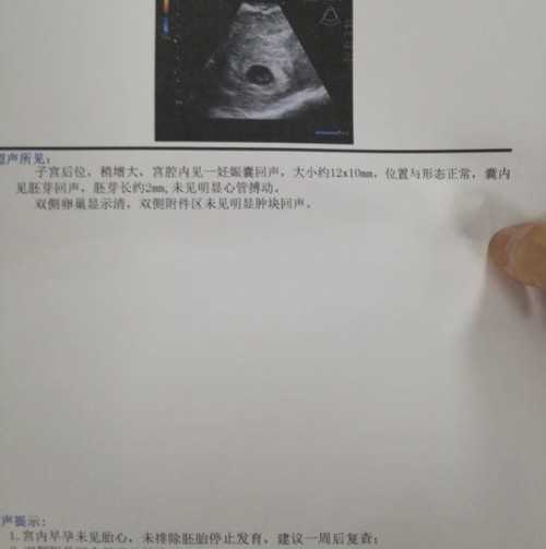上海医院有捐卵么 上海有哪些医院可以做三代试管婴儿? ‘营口伊人26周四维看