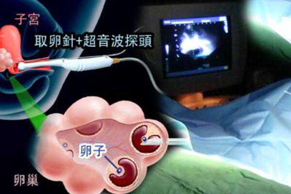 <b>上海供卵中心官网,上海助孕中心：上海试管婴儿都是双胞胎吗？</b>