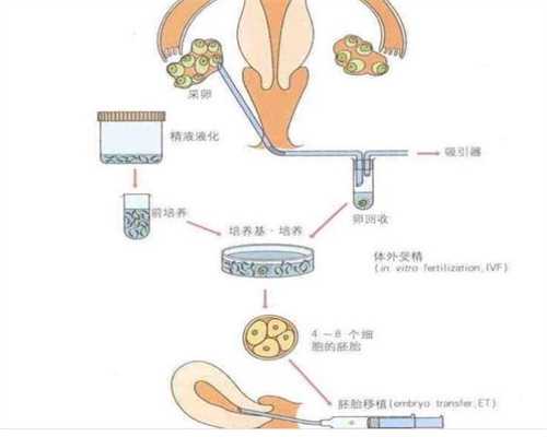 上海代孕上海代孕机构_上海世纪代怀孕方案_西安
