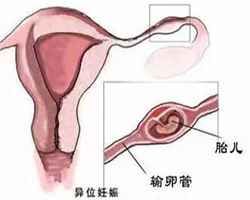 上海有私人找代孕:孕早期什么睡姿最好