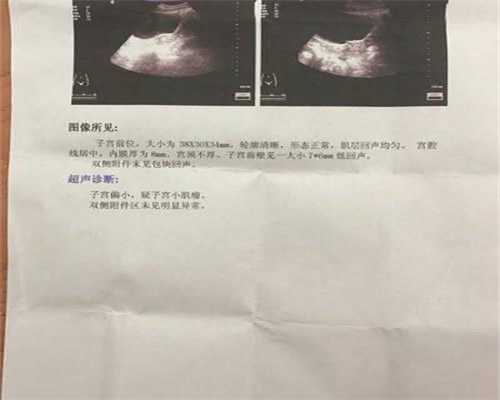 上海代孕花钱是多少_上海通过代孕获得龙凤胎