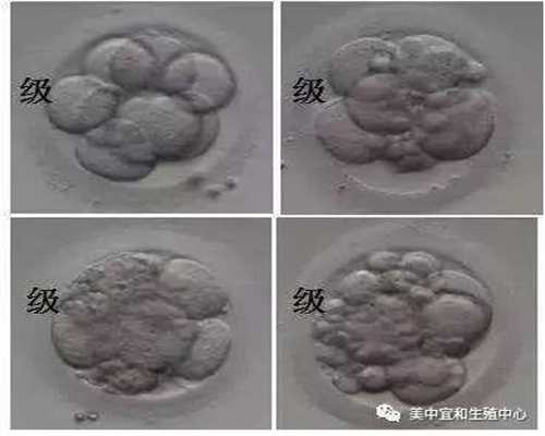 上海试管婴儿的服务好不好_上海供卵试管婴儿包成功