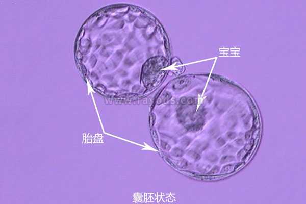 铜仁地借卵生子可行吗_泰国试管婴儿移植囊胚还是三天胚胎成功率高?