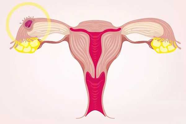 鸡西卵巢功能衰退能借卵怀孕吗_【试管婴儿流程时间表】试管婴儿进周期步骤