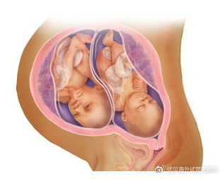 阳江可以借卵生孩子吗_人工受孕、试管婴儿怀双胞胎的几率