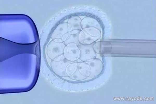 昭通代孕生殖医学中心_泰国试管婴儿专家分析：养囊的两个重要作用
