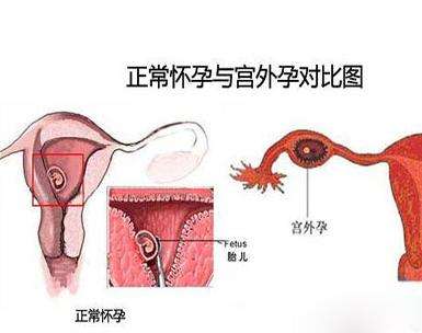 塔城代孕保密咨询_塔城代孕试管中介哪家好_珠海黄姐去日本助孕试管中孕早期