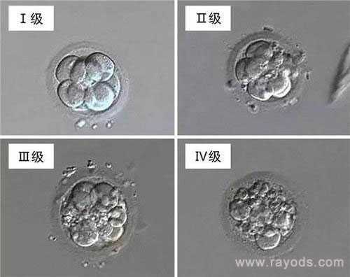 揭阳代孕中心公司电话_即便选择了优质胚胎进行日本试管婴儿移植，为什么有