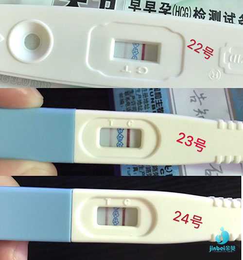 阳泉大学代孕学生_阳泉靠谱的代孕地址_我的试管婴儿经历：多囊卵巢，第二次