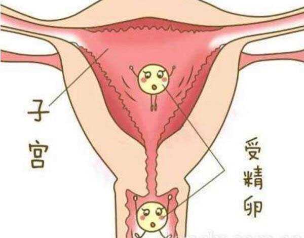文山帮人代孕费用_泰国试管婴儿可以科学避免生化妊娠吗?